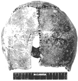 Skull